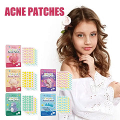 Star Pimple Patch Acne